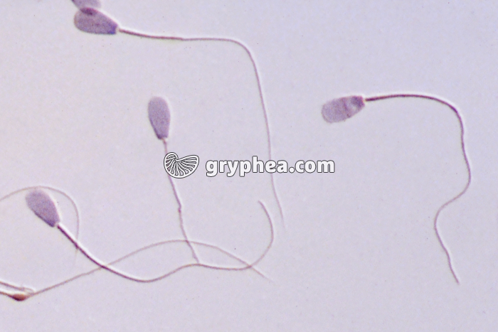 Spermatozoïdes de Taureau x250  - gryphea.com